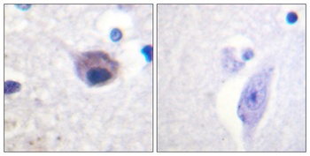 Vav2 (phospho Tyr142) rabbit pAb Antibody