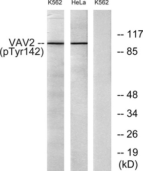 Vav2 (phospho Tyr142) rabbit pAb Antibody