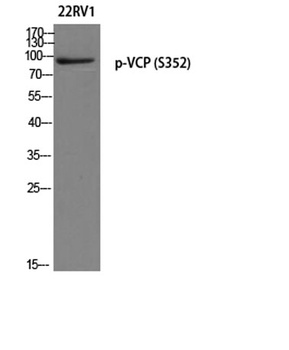 VCP (phospho Ser352) rabbit pAb Antibody