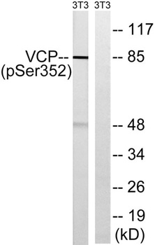 VCP (phospho Ser352) rabbit pAb Antibody