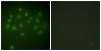 VDR (phospho Ser208) rabbit pAb Antibody