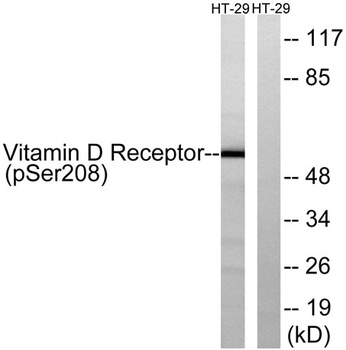 VDR (phospho Ser208) rabbit pAb Antibody