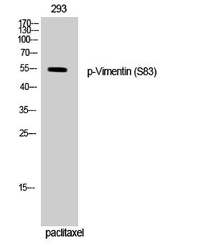 Vimentin (phospho Ser83) rabbit pAb Antibody