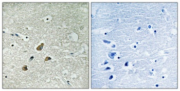 Vimentin (phospho Ser83) rabbit pAb Antibody