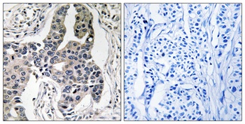 Vimentin (phospho Ser83) rabbit pAb Antibody