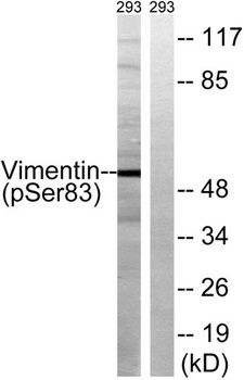 Vimentin (phospho Ser83) rabbit pAb Antibody