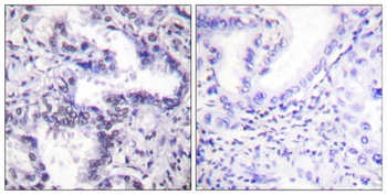 Ku-80 (phospho Thr714) rabbit pAb Antibody