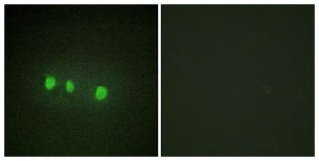 Zic1/2/3/4/5 rabbit pAb Antibody