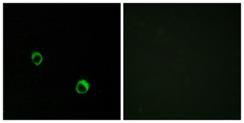 CARD 14 rabbit pAb Antibody