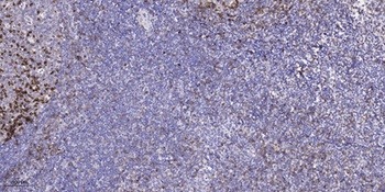CARD 14 rabbit pAb Antibody