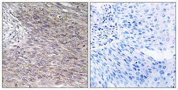 CHSY2 rabbit pAb Antibody