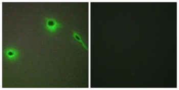 COL18A1 rabbit pAb Antibody
