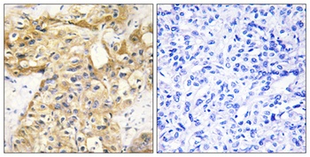 COL18A1 rabbit pAb Antibody