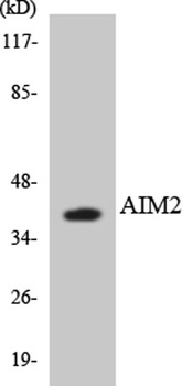 COL18A1 rabbit pAb Antibody