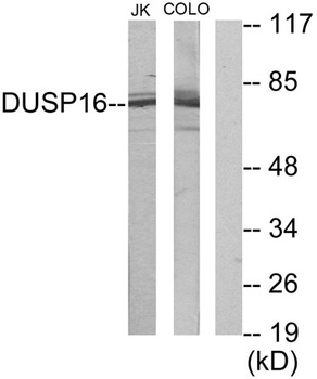 MKP-7 rabbit pAb Antibody