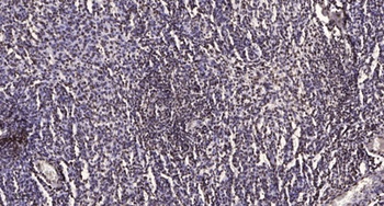 MKP-7 rabbit pAb Antibody