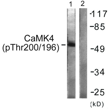 CaMKIV (phospho Thr200) rabbit pAb Antibody