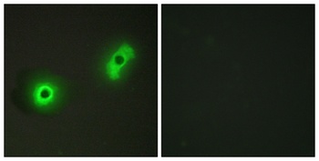 Cables2 rabbit pAb Antibody