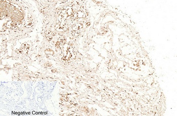Cleaved-Caspase-1 p20 (D210) rabbit pAb Antibody