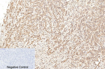 Cleaved-Caspase-1 p20 (D210) rabbit pAb Antibody