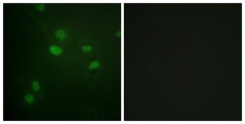 Histone H3 (phospho Thr11) rabbit pAb Antibody
