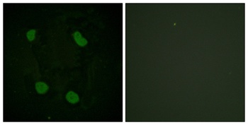 Histone H3 (Acetyl Lys14) rabbit pAb Antibody