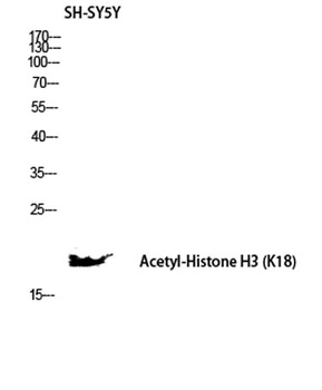 Histone H3 (Acetyl Lys18) rabbit pAb Antibody