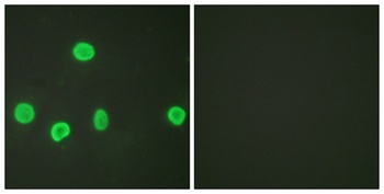 Histone H3 (Acetyl Lys18) rabbit pAb Antibody