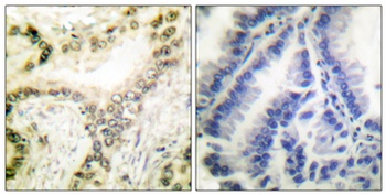 Histone H3 (Acetyl Lys18) rabbit pAb Antibody