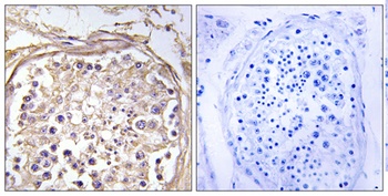 CHST9 rabbit pAb Antibody