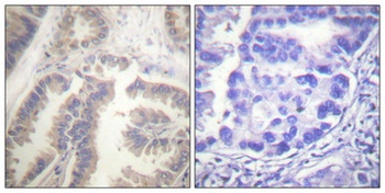 Caspase-6 (phospho Ser257) rabbit pAb Antibody