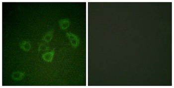 Caspase-6 (phospho Ser257) rabbit pAb Antibody