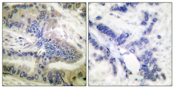 Caspase-6 (phospho Ser257) rabbit pAb Antibody
