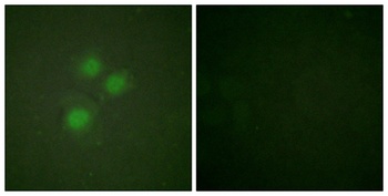 NIFK rabbit pAb Antibody