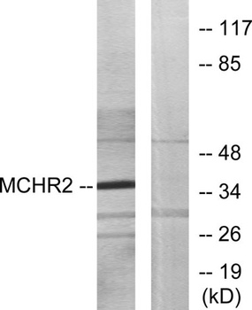 MCH-2R rabbit pAb Antibody