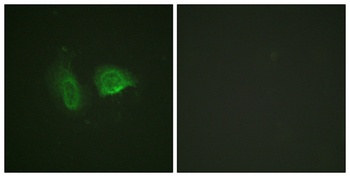 CaSR (phospho Thr888) rabbit pAb Antibody