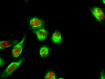 TEF-4 rabbit pAb Antibody