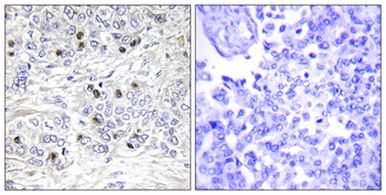 TEF-4 rabbit pAb Antibody