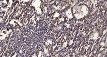 Rab 2B rabbit pAb Antibody