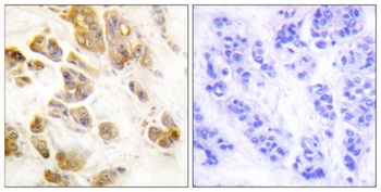 CaMKIα (phospho Thr177) rabbit pAb Antibody