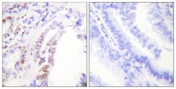 RUNX1 rabbit pAb Antibody