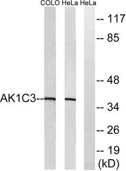 DD3 rabbit pAb Antibody