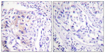 Cbl (phospho Tyr774) rabbit pAb Antibody