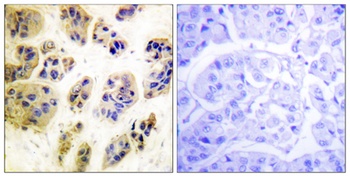 Cbl (phospho Tyr700) rabbit pAb Antibody