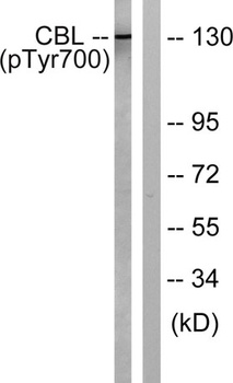 Cbl (phospho Tyr700) rabbit pAb Antibody
