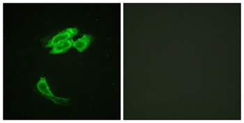 PEA-15 rabbit pAb Antibody