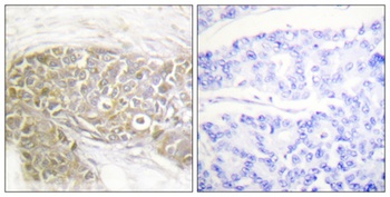 PEA-15 rabbit pAb Antibody