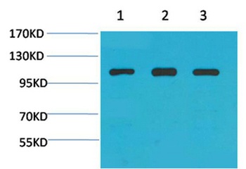 Actinin-α1 rabbit pAb Antibody