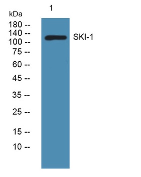 SKI-1 rabbit pAb Antibody