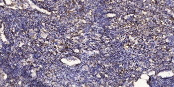 SKI-1 rabbit pAb Antibody